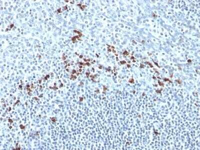 Immunohistochemistry-Paraffin: Kappa Light Chain Antibody (Kap-56) [NBP2-45087]