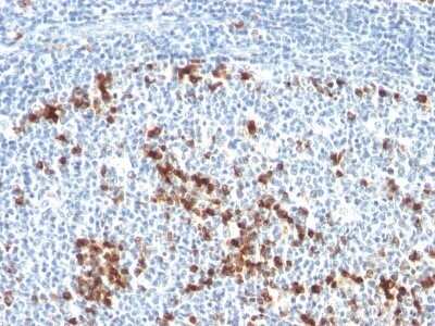 Immunohistochemistry-Paraffin: Kappa Light Chain Antibody (L1C1) - Azide and BSA Free [NBP2-33142]