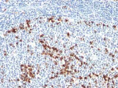 Immunohistochemistry-Paraffin: Kappa Light Chain Antibody (L1C1) [NBP2-15191]