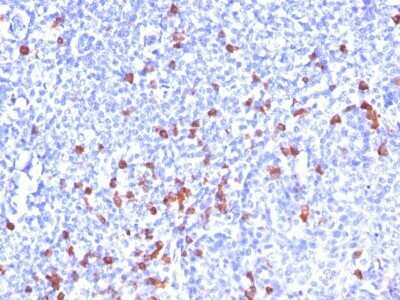 Immunohistochemistry-Paraffin: Kappa Light Chain Antibody (SPM508) - Azide and BSA Free [NBP2-34396]