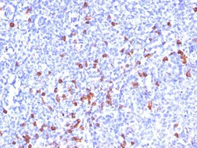 Immunohistochemistry-Paraffin: Kappa Light Chain Antibody (SPM508) [NBP2-34366]