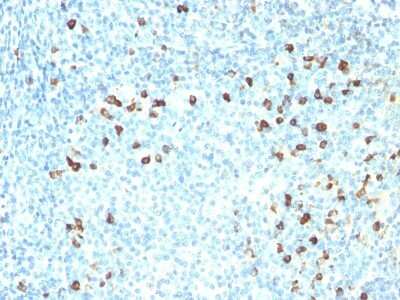 Immunohistochemistry-Paraffin: Kappa Light Chain Antibody (SPM558) - Azide and BSA Free [NBP2-34423]