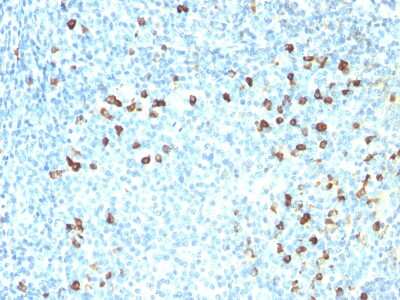 Immunohistochemistry-Paraffin: Kappa Light Chain Antibody (SPM558) [NBP2-34376]