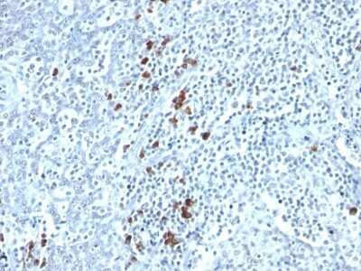 Immunohistochemistry-Paraffin: Kappa Light Chain Antibody (TB28-2) - IHC-Prediluted [NBP2-45083]