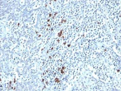 Immunohistochemistry-Paraffin: Kappa Light Chain Antibody (TB28-2) [NBP2-34256]