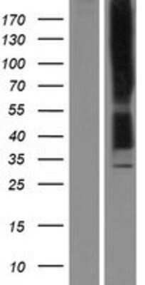 Western Blot: KOR Overexpression Lysate [NBP2-04181]