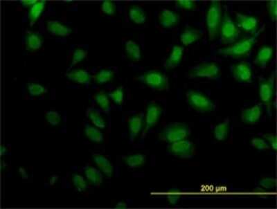 Immunocytochemistry/ Immunofluorescence: Kaptin Antibody (1C7) [H00011133-M01]