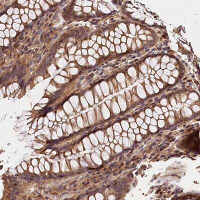 Immunohistochemistry-Paraffin: Kaptin Antibody [NBP1-92035]