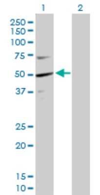 Western Blot: Kaptin Antibody [H00011133-D01P]