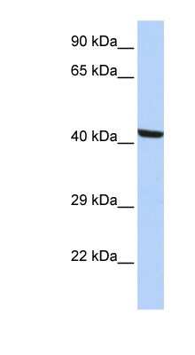 Western Blot: Kaptin Antibody [NBP1-55221]