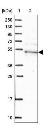 Western Blot: Kaptin Antibody [NBP1-92035]