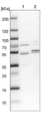 Western Blot: Kaptin Antibody [NBP1-92035]