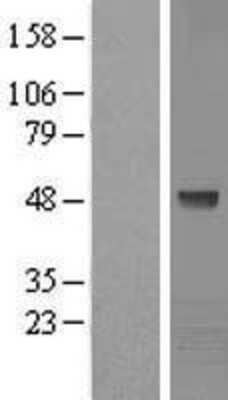 Western Blot: Kaptin Overexpression Lysate [NBL1-12375]