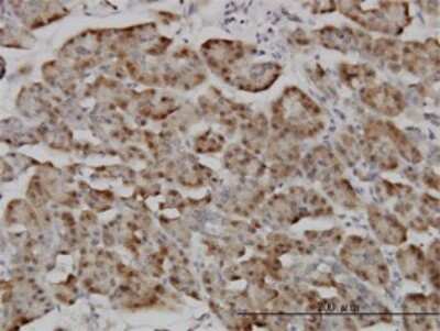 Immunohistochemistry-Paraffin: Karyopherin (importin) beta 3 Antibody (1C4) [H00003843-M01]