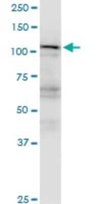 Western Blot: Karyopherin (importin) beta 3 Antibody (1C4) [H00003843-M01]