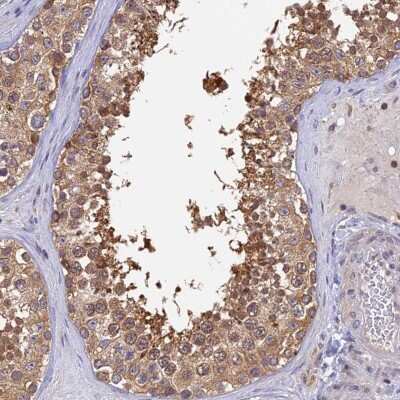 Immunohistochemistry-Paraffin: Karyopherin (importin) beta 3 Antibody [NBP2-38480]