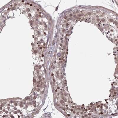 Immunohistochemistry-Paraffin: Karyopherin (importin) beta 3 Antibody [NBP2-38795]