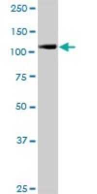 Western Blot: Karyopherin (importin) beta 3 Antibody [H00003843-B01P]