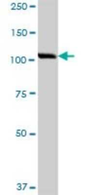 Western Blot: Karyopherin (importin) beta 3 Antibody [H00003843-B01P]