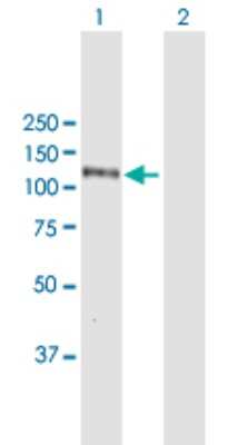 Western Blot: Karyopherin (importin) beta 3 Antibody [H00003843-B01P]