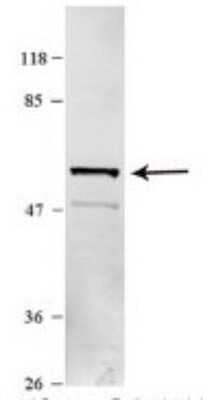 Western Blot: Karyopherin (importin) beta 3 Antibody [NBP1-79535]