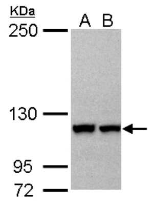 Western Blot: Karyopherin (importin) beta 3 Antibody [NBP2-17016]
