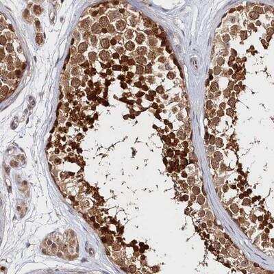 Immunohistochemistry-Paraffin: Katanin p60 Antibody [NBP1-89491]