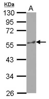 Western Blot: Katanin p60 Antibody [NBP2-17019]