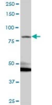 Western Blot: Kazrin Antibody [H00023254-B01P]