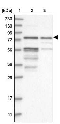 Western Blot: Kazrin Antibody [NBP1-92038]