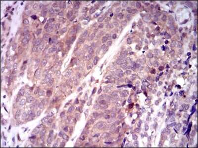Immunohistochemistry-Paraffin: Keap1 Antibody (7G4B10) - BSA Free [NBP2-37431]