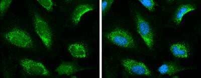 Immunocytochemistry/ Immunofluorescence: Keap1 Antibody [NBP2-17036]