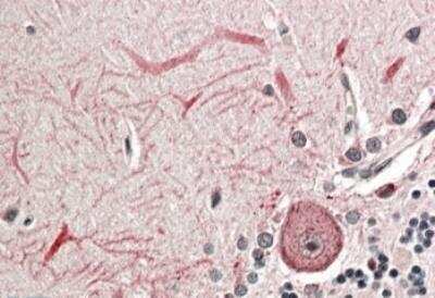 Immunohistochemistry-Paraffin: Keap1 Antibody [NBP1-78793]