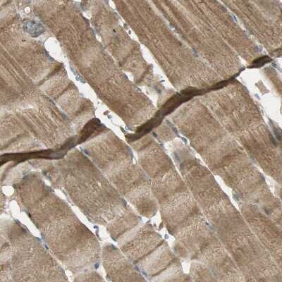 Immunohistochemistry-Paraffin: Keap1 Antibody [NBP1-83106]