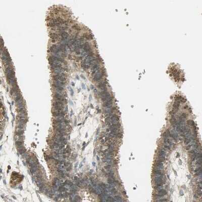 Immunohistochemistry-Paraffin: Keap1 Antibody [NBP1-83106]