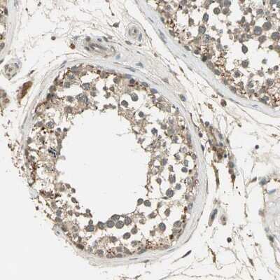 Immunohistochemistry-Paraffin: Keap1 Antibody [NBP1-83106]