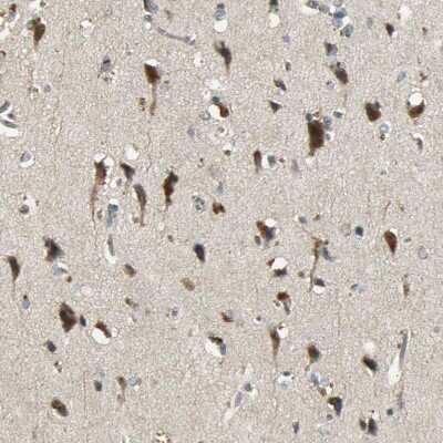 Immunohistochemistry-Paraffin: Keap1 Antibody [NBP1-83106]