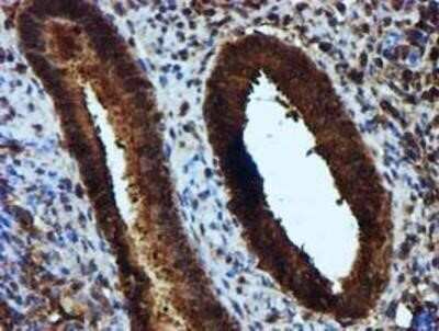 Immunohistochemistry: Keap1 Antibody (OTI1B4) - Azide and BSA Free [NBP2-71496]