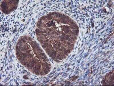 Immunohistochemistry-Paraffin: Keap1 Antibody (OTI1B4) [NBP2-03319]