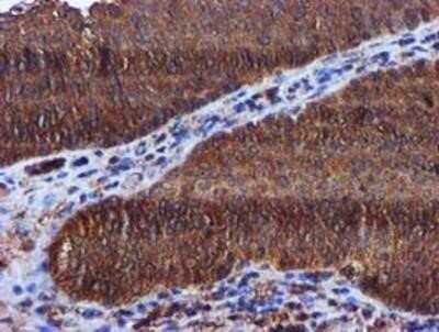 Immunohistochemistry-Paraffin: Keap1 Antibody (OTI1B4) [NBP2-03319]