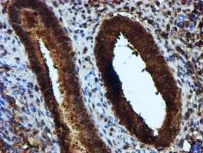 Immunohistochemistry-Paraffin: Keap1 Antibody (OTI1B4) [NBP2-03319]