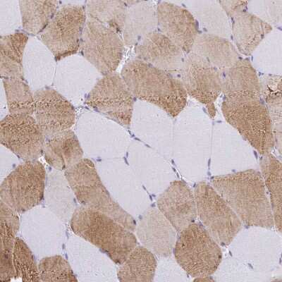 Immunohistochemistry-Paraffin: Kelch Domain Containing 7A Antibody [NBP2-30941]