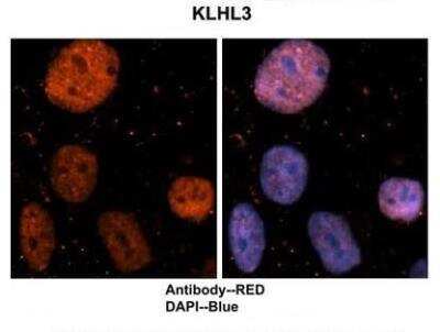 Immunohistochemistry: Kelch-Like 3 Antibody [NBP2-87673]