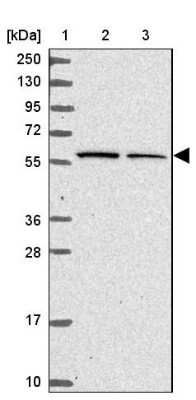 Western Blot: Kelch-Like 3 Antibody [NBP2-14168]