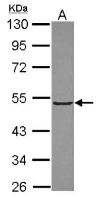 Western Blot: Kelch-Like 3 Antibody [NBP2-17037]