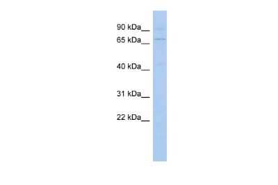 Western Blot: Kelch-Like 3 Antibody [NBP2-87673]