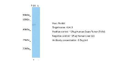 Western Blot: Kelch-Like 3 Antibody [NBP2-87675]