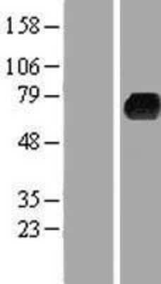 Western Blot: Kelch-Like 3 Overexpression Lysate [NBP2-06980]