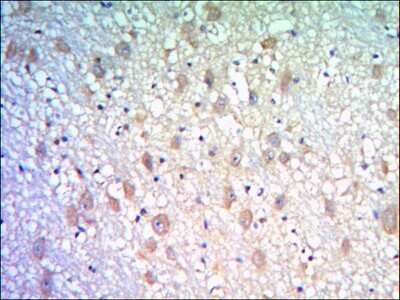 Immunohistochemistry: Kelch-Like Family Member 21 Antibody (2H4) - BSA Free [NBP2-37659]
