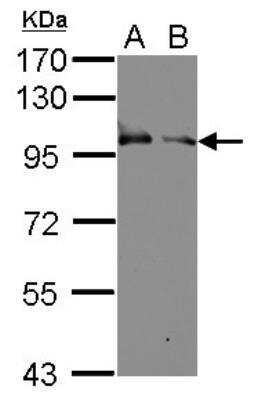 Western Blot: Kell Antibody [NBP1-33660]